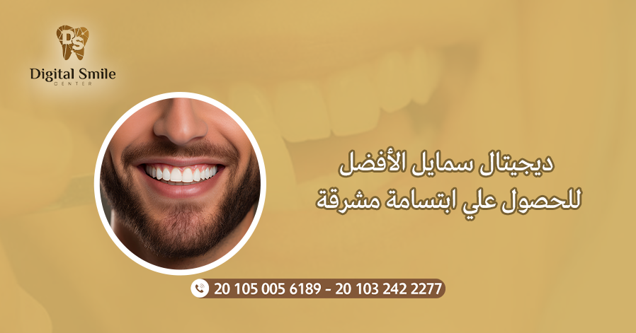 فوائد واضرار ابتسامة هوليود