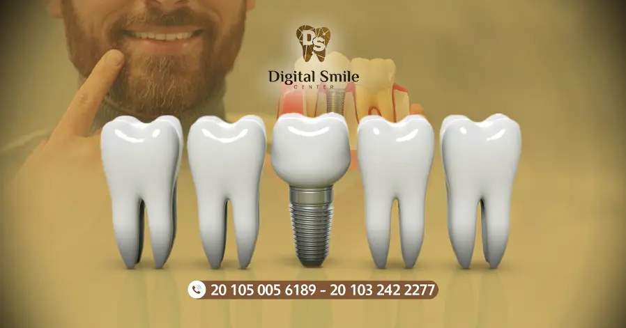 ديجيتال سمايل افضل مراكز الاسنان فى مصر 