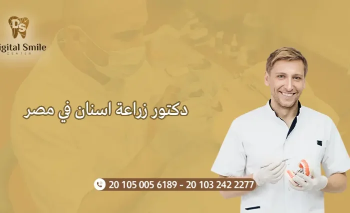 افضل دكتور زراعة اسنان في مصر 2025