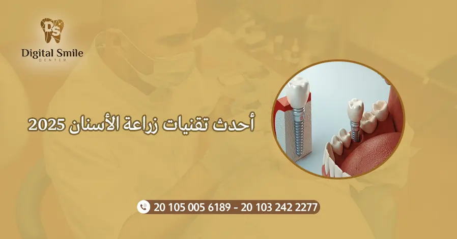 أحدث تقنيات زراعة الأسنان 2025