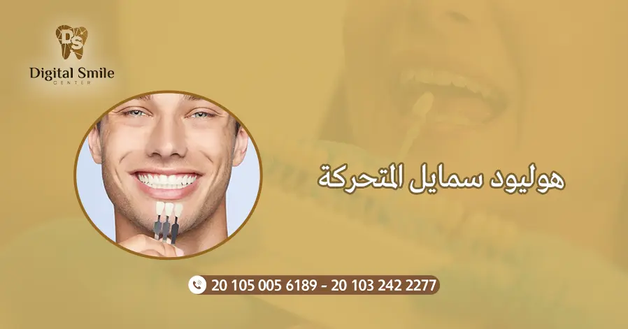 هوليود سمايل المتحركة