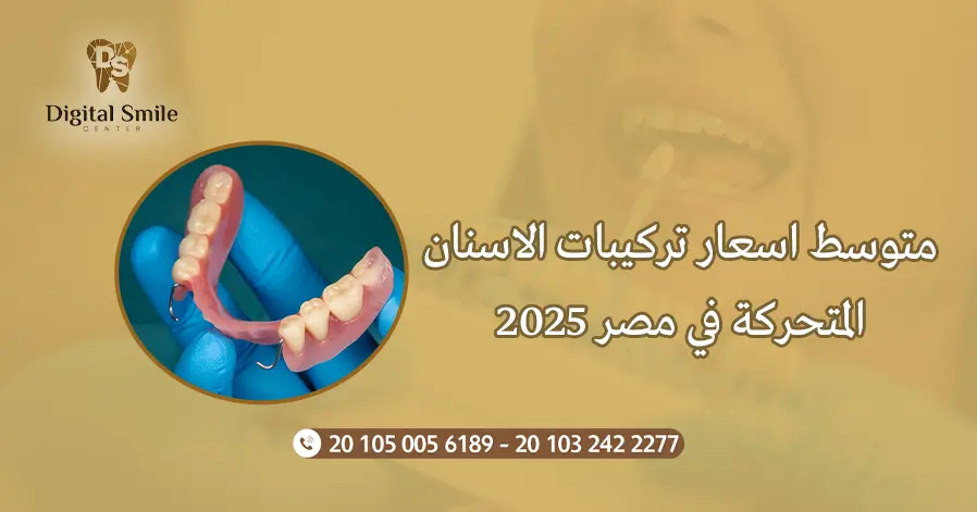 متوسط اسعار تركيبات الاسنان المتحركة في مصر 2025