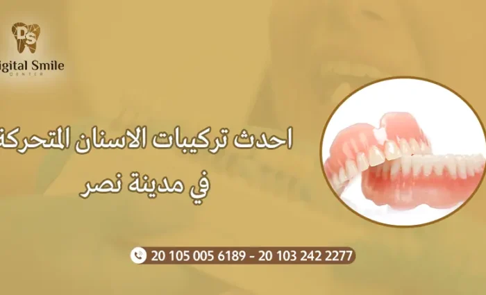 احدث تركيبات الاسنان المتحركة في مدينة نصر