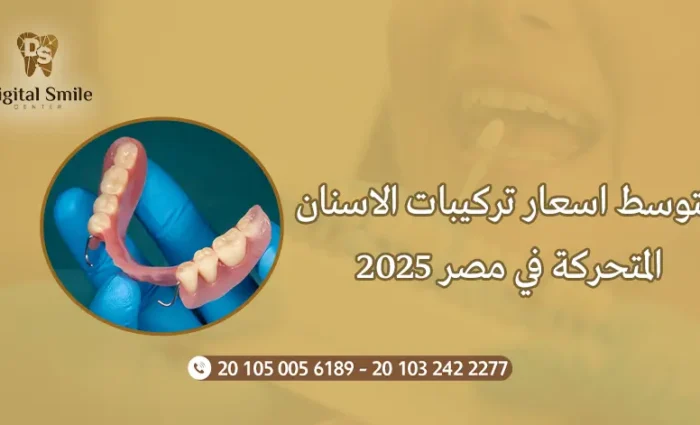 متوسط اسعار تركيبات الاسنان المتحركة في مصر 2025